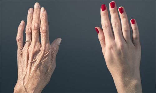 Por qué las manos delatan la edad y hasta dónde ha llegado la cosmética para impedirlo