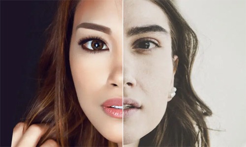 El auge imparable de la medicina estética: “El relleno de labios es el nuevo tatuaje”